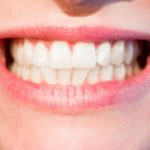 Aktualna technika używana w salonach stomatologii estetycznej być może sprawić, że odzyskamy prześliczny uśmiech.